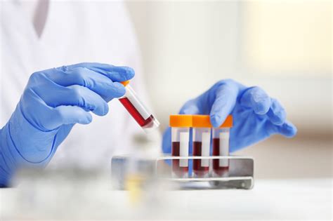 Blood lab test in .